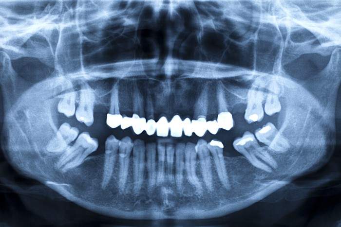 clinica dentale torino odontolarc panoramica